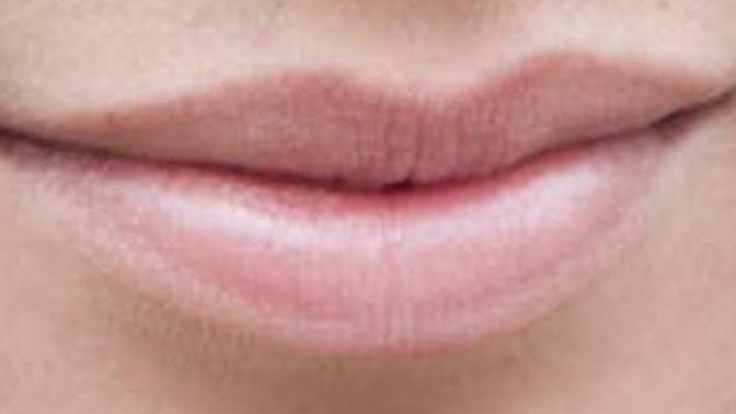 Should get my lips plumped up with fillers, especially the upper one? What do you think?