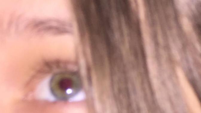 Why Does Flash Make My Eyeballs Red?