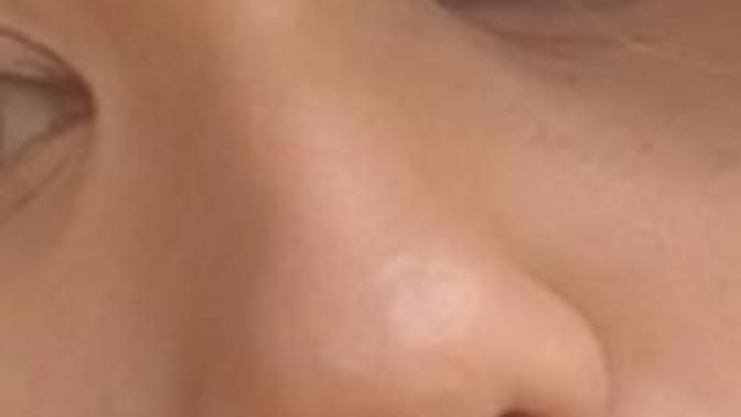 Should I get a nose job?