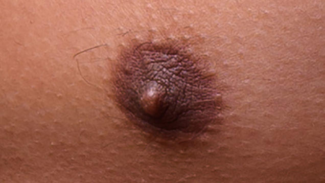 Is one of these a female nipple?