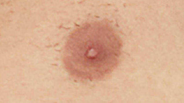 Is one of these a female nipple?