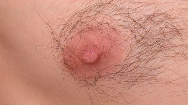 Is one of these a female nipple?