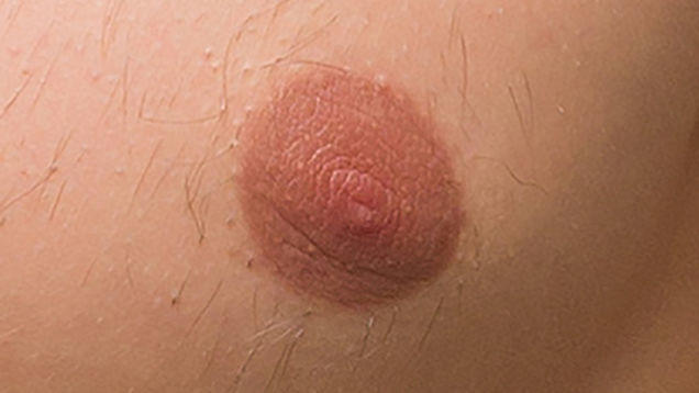Is one of these a female nipple?