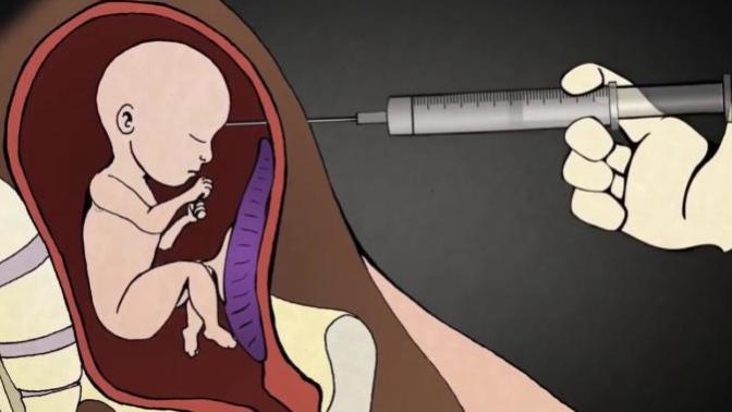 What do you think of full term abortions?