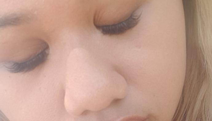 Should I get a nose job or not?