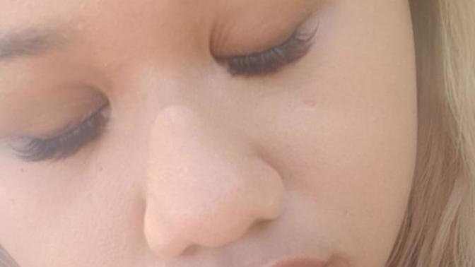 Should I get a nose job or not?