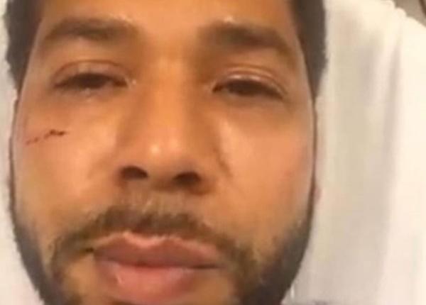 Do you think 'Empire' actor Jussie Smollett fabricated any part of his story about being attacked and assaulted?