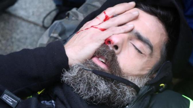 The Yellow vest protesters in France are putting yellow stickers on their eyes because police are targeting them in the eyes, thoughts?
