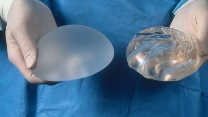 If a guy buys you breast implants, does he own them?