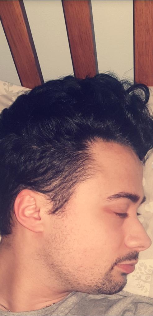 Is this a MATURE hairline OR reversing Hairline and am I going BALD?