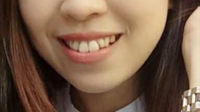 Guys, girl with rabbit teeth - OK or NO?