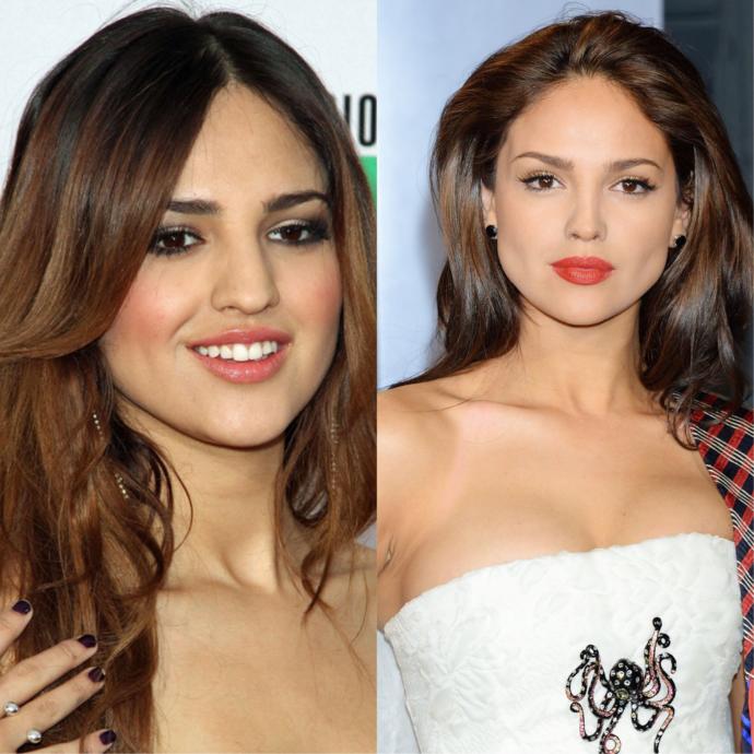 Is this the Best plastic surgery transformation EVER?