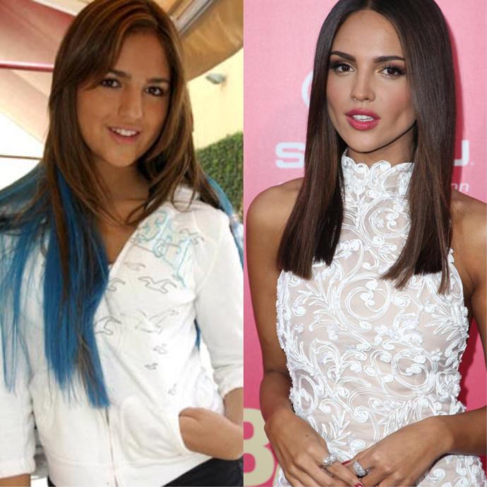 Is this the Best plastic surgery transformation EVER?