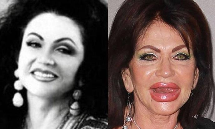 Is this the Best plastic surgery transformation EVER?