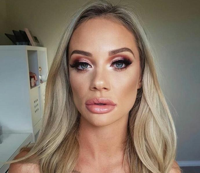 Do you guys like lip fillers? If so, why?