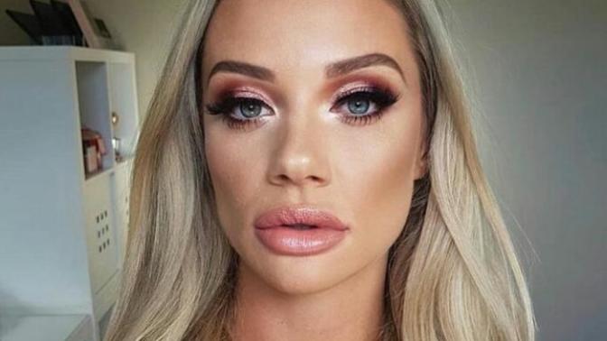 Do you guys like lip fillers? If so, why?