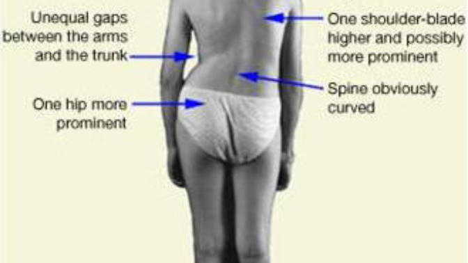 Is an uneven torso unattractive?
