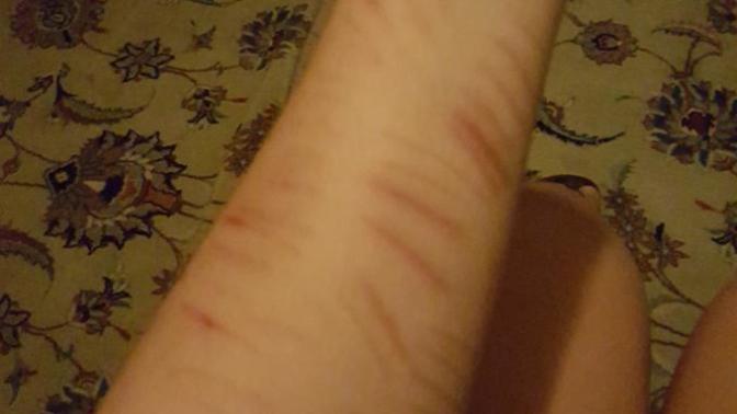Would you not date a woman with scars like these?