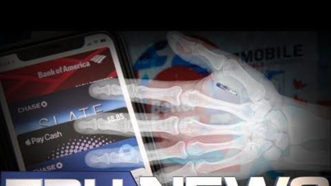 How many of you will accept microchip implants?