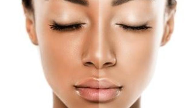 What are your thoughts on skin bleaching?