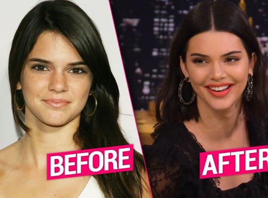 Who is hotter? Kylie or Kendall?