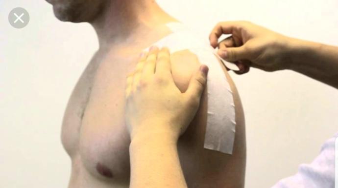 Are these pecs or moobs?