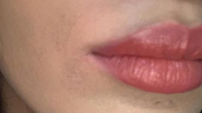 I'm 17 Andi have fine lines around my mouth is that normal? does it mean that I will age bad?