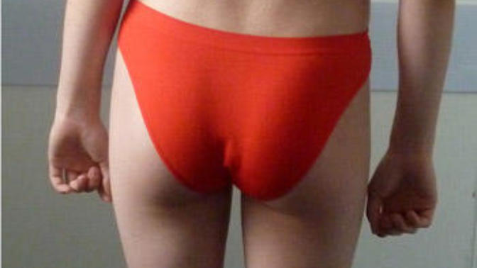 Could you be attracted to a girl with an uneven body like this?