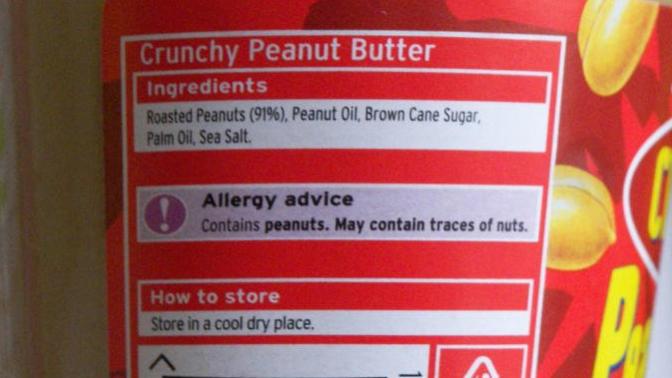 Do you have any allergies and what are they?