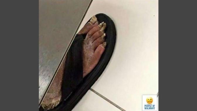 Do you have nice looking feet or are your toenails all gnarly?