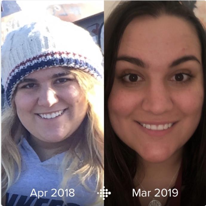 Facial weight loss?