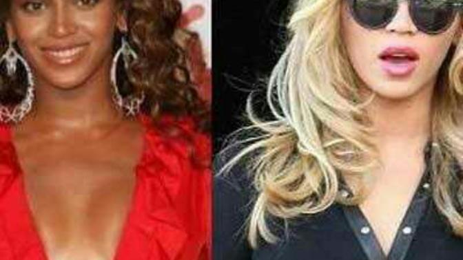 Why does Beyoncé bleach her skin and hair?