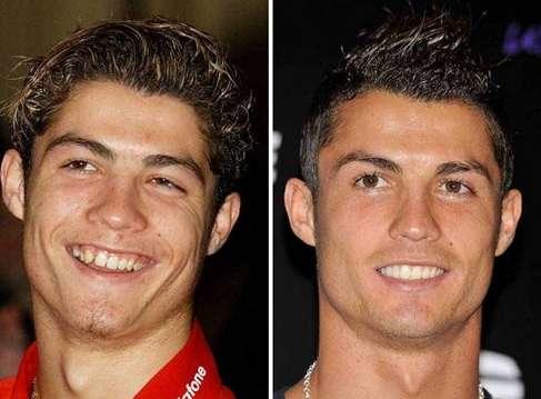 Do you think plastic surgery is false advertising?