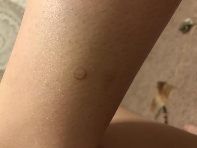I have a cut that’s the exact shape of a circle?