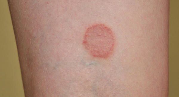 I have a cut that’s the exact shape of a circle?