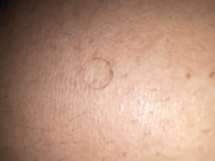 I have a cut that’s the exact shape of a circle?