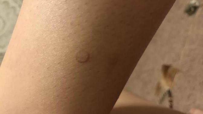 I have a cut that’s the exact shape of a circle?
