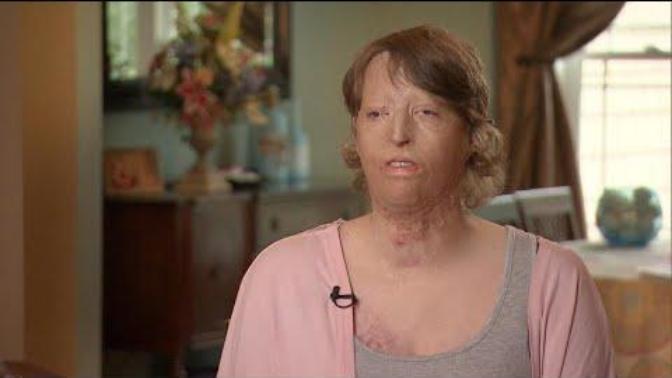 Would you still be with your partner if they had an accident that mutilated their face?