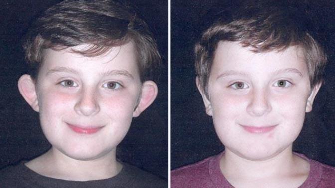 Would you allow your child to have cosmetic surgery if they were being viciously bullied because of the way they looked?