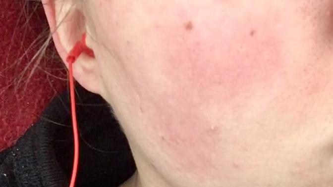 Whats wrong with my skin?