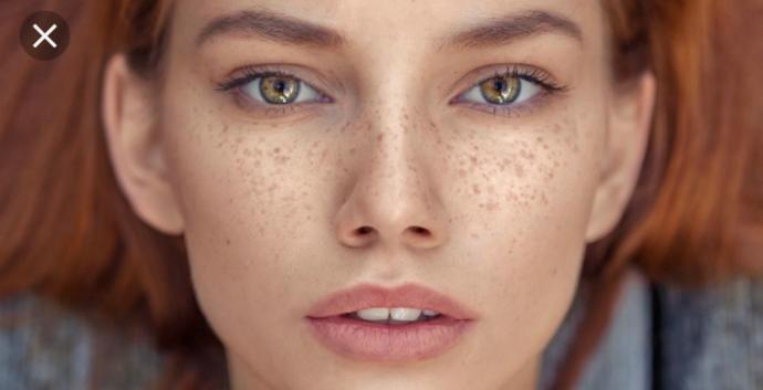 Are freckles cute or unattractive in your opinion?