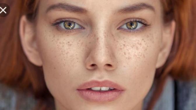 Are freckles cute or unattractive in your opinion?