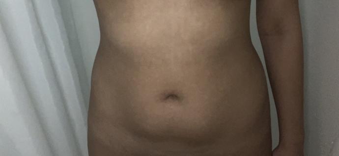 Are belly pouches attractive?