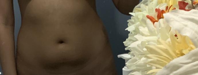 Are belly pouches attractive?