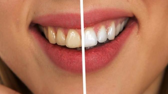 Would you date someone with bad oral hygiene?