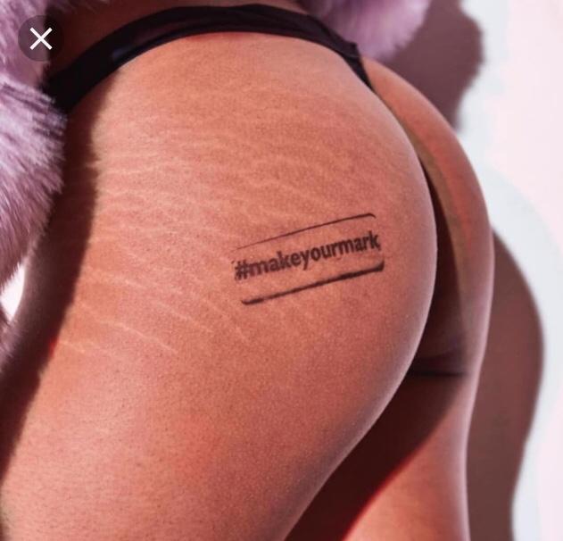 Are stretch marks a turn off? Please be honest?