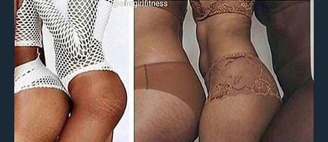 Are stretch marks a turn off? Please be honest?