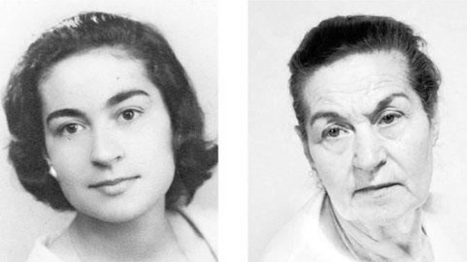 Why Do Old People Have Big Noses & Ears?