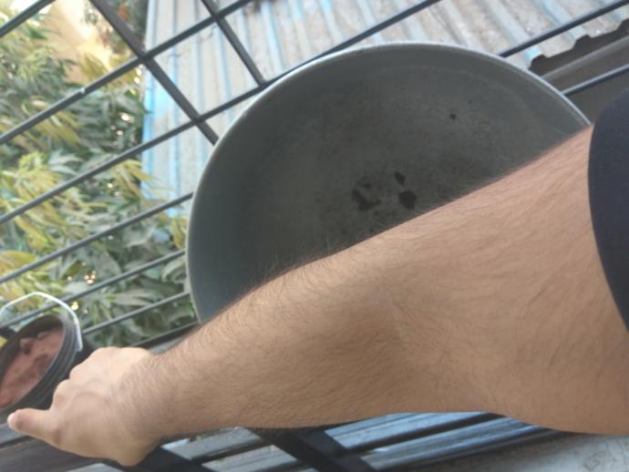 I am 27 male. As per upload photos, am I too hairy? If so what do I do?