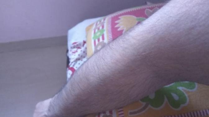 I am 27 male. As per upload photos, am I too hairy? If so what do I do?